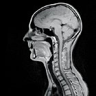 MRI Scan Phoenix Arizona, Brain, Spine, Joints, Abdomen, Pelvis