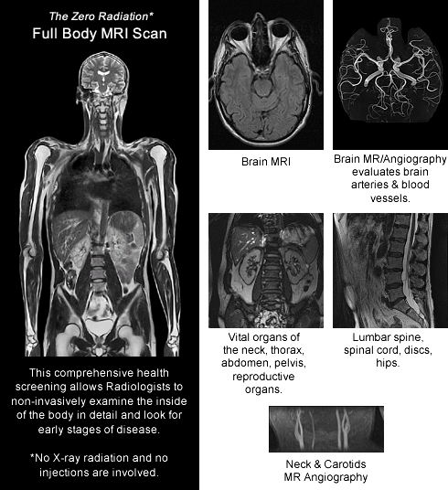Full Body MRI Scan